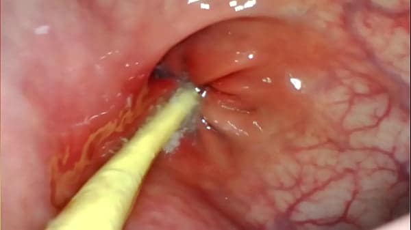 EXTREME ANAL POV. CAMERA INSIDE HER ASSHOLE AS I POUND HER WITH MY BIG COCK AND CUM DEEP INSIDE